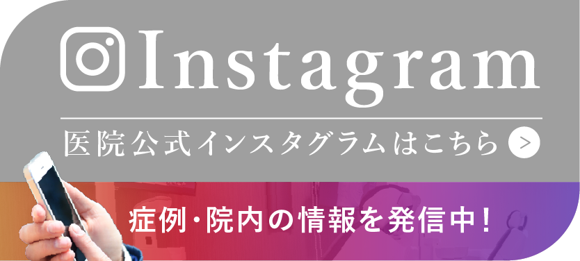 インスタグラム